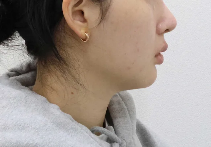 手術前